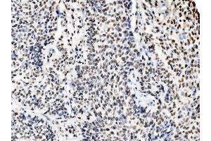 IHC analysis of DBC-1/CCAR2 using anti-DBC-1/CCAR2 antibody (ABIN7602235). (CCAR2 antibody  (AA 65-917))