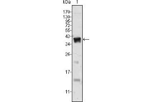 Western blot analysis using Androgen receptor mouse mAb against human recombinant Androgen receptor. (Androgen Receptor antibody)
