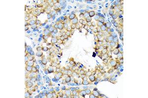 Immunohistochemistry of paraffin-embedded mouse testis using  Rabbit mAb (ABIN7265532) at dilution of 1:100 (40x lens). (ALDH1A2 antibody)