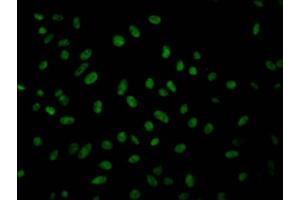 Immunofluorescence staining of Hela Cells with ABIN7127514 at 1:50, counter-stained with DAPI. (Recombinant Geminin antibody)