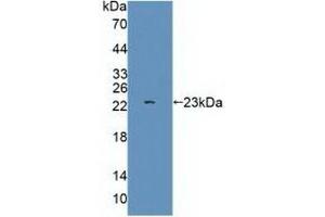 Detection of Recombinant GRIA3, Human using Polyclonal Antibody to Glutamate Receptor, Ionotropic, AMPA 3 (GRIA3) (Glutamate Receptor 3 antibody  (AA 649-823))