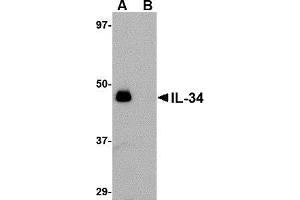 Western blot analysis of IL-34 in human brain tissue lysate with AP30428PU-N IL-34 antibody at 0. (IL-34 antibody  (N-Term))