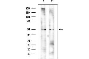 anti-DEAD (Asp-Glu-Ala-Asp) Box Polypeptide 39A (DDX39) antibody