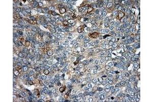 Immunohistochemical staining of paraffin-embedded Kidney tissue using anti-SIL1 mouse monoclonal antibody. (SIL1 antibody)