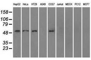 Image no. 2 for anti-Solute Carrier Family 2 (Facilitated Glucose/fructose Transporter), Member 5 (SLC2A5) antibody (ABIN1498479) (SLC2A5 antibody)