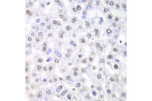 Immunohistochemistry of paraffin-embedded rat liver using Nono Antibody (ABIN5973035) at dilution of 1/100 (40x lens). (NONO antibody)