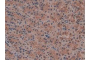 IHC-P analysis of Rat Stomach Tissue, with DAB staining. (OTUB1 antibody  (AA 1-271))