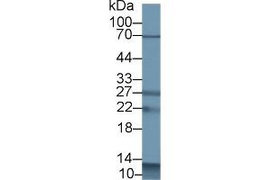 Detection of S100A12 in Porcine Spleen lysate using Polyclonal Antibody to S100 Calcium Binding Protein A12 (S100A12) (S100A12 antibody  (AA 2-92))