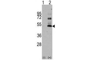 Image no. 1 for anti-Microtubule-Associated Protein tau (MAPT) antibody (ABIN356907)