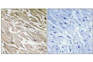 Immunohistochemistry analysis of paraffin-embedded human heart tissue using PPP1R2 (Phospho-Ser120+Ser121) antibody. (PPP1R2 antibody  (pSer120, pSer121))