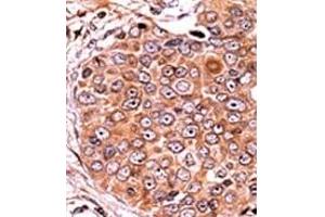 Image no. 2 for anti-SMAD, Mothers Against DPP Homolog 3 (SMAD3) (pSer208) antibody (ABIN358225) (SMAD3 antibody  (pSer208))