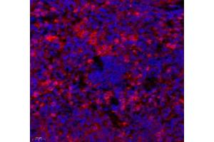 Immunofluorescence of paraffin embedded mouse spleen using cfap58 (ABIN7073535) at dilution of 1: 650 (400x lens) (CCDC147 antibody)