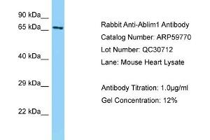 Western Blotting (WB) image for anti-Actin Binding LIM Protein 1 (ABLIM1) (Middle Region) antibody (ABIN2788205) (ABLIM1 antibody  (Middle Region))