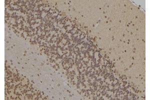 ABIN6277062 at 1/100 staining Rat brain tissue by IHC-P. (FANCD2 antibody  (Internal Region))