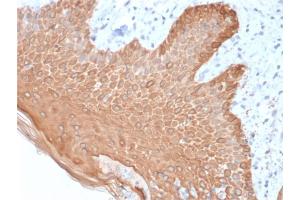 Formalin-fixed, paraffin-embedded human Skin stained with Multi-Cytokeratin Mouse Recombinant Monoclonal Antibody (rKRT/457). (Recombinant Cytokeratin, Multi (Epithelial Marker) antibody)