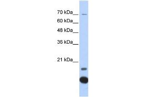 WB Suggested Anti-TXN2 Antibody Titration: 0. (TXN2 antibody  (Middle Region))