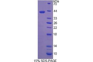 Image no. 1 for Retinaldehyde Binding Protein 1 (RLBP1) (AA 1-317) protein (His tag) (ABIN6237901) (RLBP1 Protein (AA 1-317) (His tag))