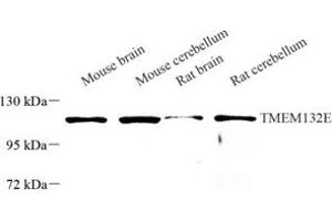 Western blot analysis of TMEM132E (ABIN7075991) at dilution of 1: 250