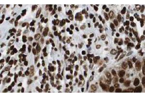 Image no. 3 for anti-Histone Deacetylase 1 (HDAC1) (AA 466-482) antibody (ABIN401309) (HDAC1 antibody  (AA 466-482))
