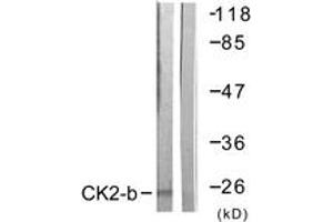 Western blot analysis of extracts from HuvEc cells, using CKII-beta (Ab-209) Antibody. (CSNK2B antibody  (AA 166-215))