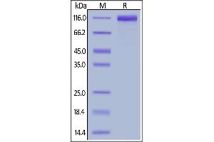 Human IL-31 RA, Fc Tag on  under reducing (R) condition. (IL31RA Protein (AA 20-519) (Fc Tag))