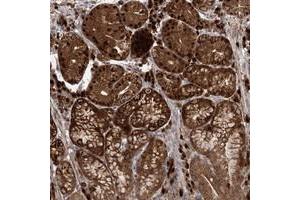 Immunohistochemical staining of human stomach with WDR75 polyclonal antibody  shows strong nuclear, nucleolar and cytoplasmic positivity in glandular cells at 1:50-1:200 dilution. (WDR75 antibody)