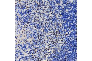 Immunohistochemistry of paraffin-embedded rat spleen using K/TRIM28 antibody (ABIN7270986) at dilution of 1:100 (40x lens). (KAP1 antibody)