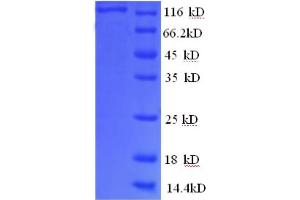 SDS-PAGE (SDS) image for phosphorylase, Glycogen, Brain (GPBB) (AA 6-843), (partial) protein (GST tag) (ABIN4976462) (PYGB Protein (AA 6-843, partial) (GST tag))