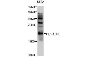 Western blot analysis of extracts of K562 cells, using PLA2G10 antibody (ABIN4904779) at 1:1000 dilution.