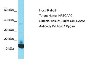 Host: Rabbit Target Name: KRTCAP2 Sample Tissue: Human Jurkat Whole Cell Antibody Dilution: 1ug/ml (KRTCAP2 antibody  (C-Term))