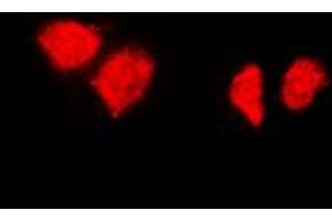 Immunofluorescent analysis of HSP40 staining in HeLa cells.