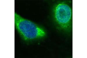 Human Melanoma cell line C 32 was cultured overnight on round cover slides placed in a 24 well tissue culture plate. (CD36 antibody  (Extracellular Domain))