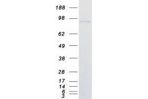 Validation with Western Blot (ZBTB17 Protein (Myc-DYKDDDDK Tag))