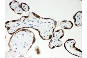 Immunohistochemistry (Paraffin-embedded Sections) (IHC (p)) image for anti-Pregnancy-Associated Plasma Protein A, Pappalysin 1 (PAPPA) (AA 95-388) antibody (ABIN3043377) (PAPPA antibody  (AA 95-388))