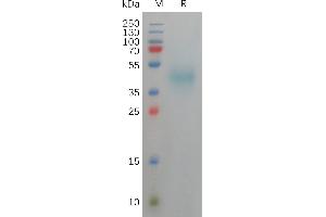 Human Protein, His Tag on SDS-PAGE under reducing condition.