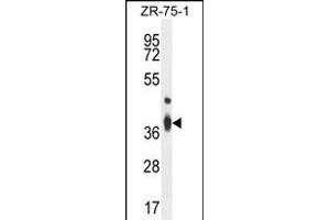 TMBIM4 Antibody (N-term) (ABIN654453 and ABIN2844187) western blot analysis in ZR-75-1 cell line lysates (35 μg/lane). (TMBIM4 antibody  (N-Term))