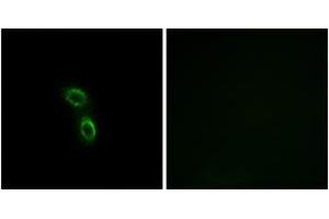 Immunofluorescence analysis of A549 cells, using ARMC6 Antibody. (ARMC6 antibody  (AA 431-480))