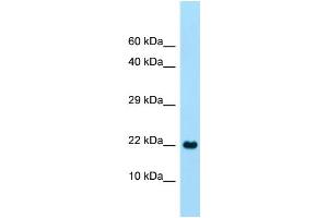 WB Suggested Anti-CLEC2A Antibody Titration: 1. (CLEC2A antibody  (C-Term))