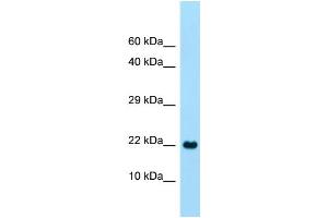 WB Suggested Anti-CLEC2A Antibody Titration: 1.