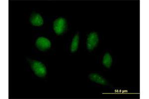 Immunofluorescence of purified MaxPab antibody to ADAMTSL4 on HeLa cell. (ADAMTSL4 antibody  (AA 1-424))