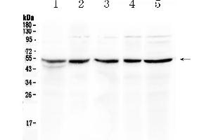 Western blot analysis of EIF3e using anti- EIF3e antibody . (EIF3E antibody  (AA 160-241))