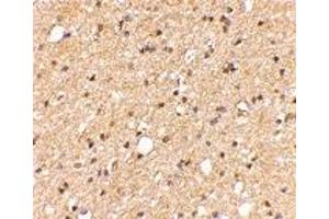 Immunohistochemistry (IHC) image for anti-Leucine-Rich Repeat LGI Family, Member 2 (LGI2) (Middle Region) antibody (ABIN1030982) (LGI2 antibody  (Middle Region))