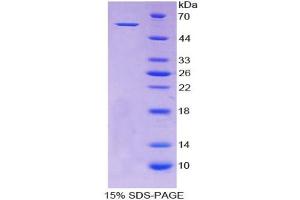 SDS-PAGE analysis of Human ALDH7A1 Protein.