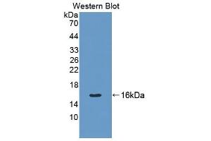 Detection of Recombinant CK7, Rat using Polyclonal Antibody to Cytokeratin 7 (CK7) (Cytokeratin 7 antibody  (AA 394-457))