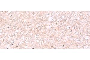 Immunohistochemistry of paraffin-embedded Human brain tissue using RABEPK Polyclonal Antibody at dilution of 1:85(x200) (RABEPK antibody)