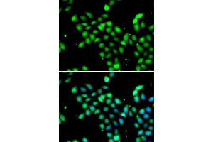 Immunofluorescence analysis of A549 cell using METTL13 antibody. (METTL13 antibody)