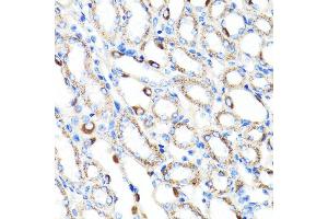 Immunohistochemistry of paraffin-embedded mouse kidney using RNF149 antibody (ABIN7270062) at dilution of 1:100 (40x lens). (RNF149 antibody  (AA 221-400))