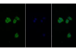 Detection of EIF2aK3 in Human Hela cell using Polyclonal Antibody to Eukaryotic Translation Initiation Factor 2 Alpha Kinase 3 (EIF2aK3) (PERK antibody  (AA 973-1114))