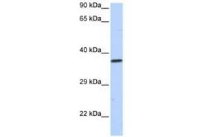 Image no. 1 for anti-Sex Comb On Midleg-Like 1 (SCML1) (AA 36-85) antibody (ABIN6740440) (SCML1 antibody  (AA 36-85))