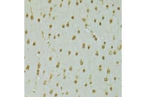 Immunohistochemistry (Paraffin-embedded Sections) (IHC (p)) image for anti-Regulator of Chromosome Condensation 1 (RCC1) (AA 1-240) antibody (ABIN6146817)
